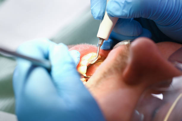 Best Dentist for Tooth Abscess  in Pasco, WA
