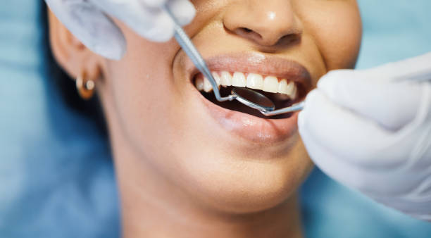 Best Chipped Tooth Repair Near Me  in Pasco, WA