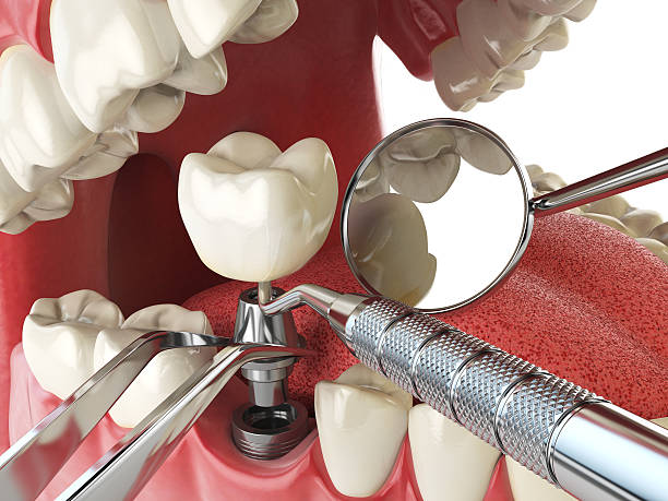 Emergency Dentist Open Today in WA